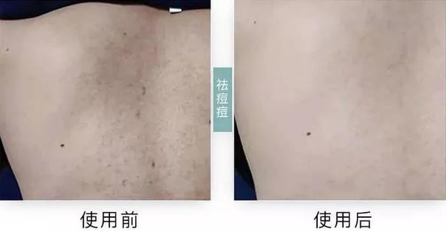 雅顿哪款身体乳比较好