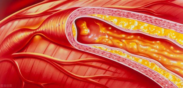 脑血栓形成的原因？脑血栓有哪些常见病因