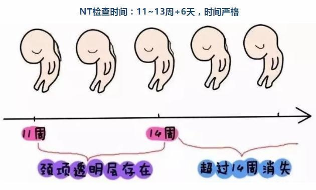 b超检查报fnt什么意思