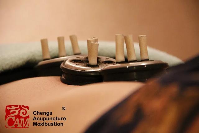 心脑血管疾病进入高发期，养生防病艾灸12背俞穴