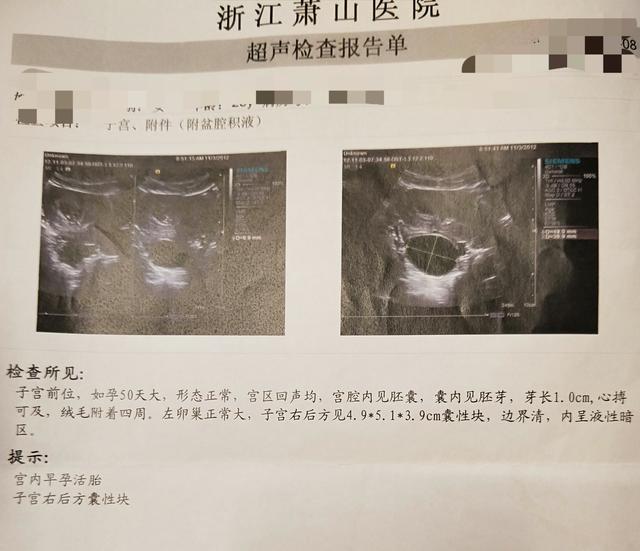 从怀孕到生产的个人经历