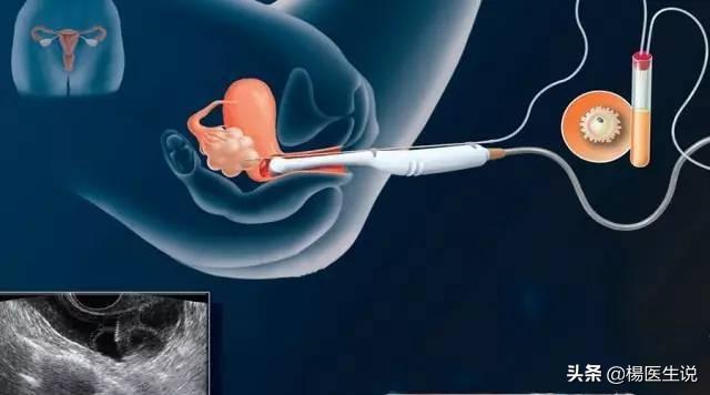 越来越多的人选择做“试管婴儿”，试管婴儿与正常人一样健康吗？