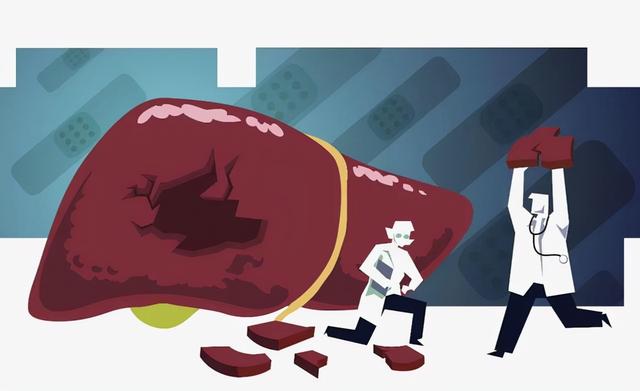 缓解肝纤维化饮食原则：2缺3补要记住