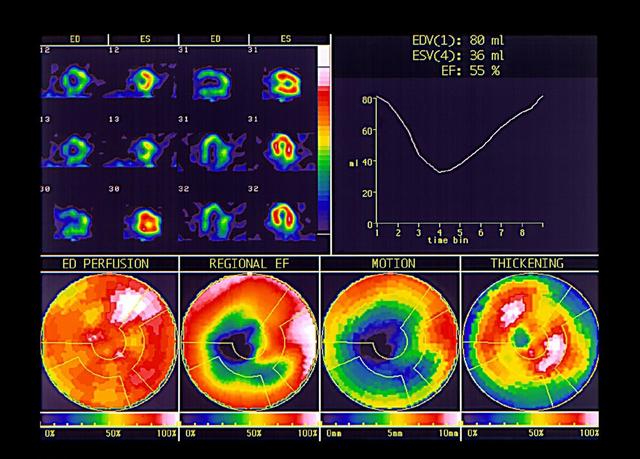 它从6方面，多靶点改善冠心病心绞痛、心衰、心梗，促进心脏康复
