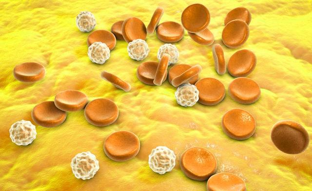 艾滋病三周皮肤角化严重