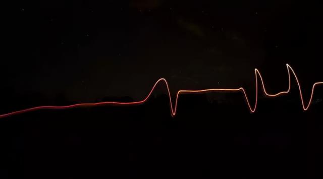 心律失常患者日常生活小贴士