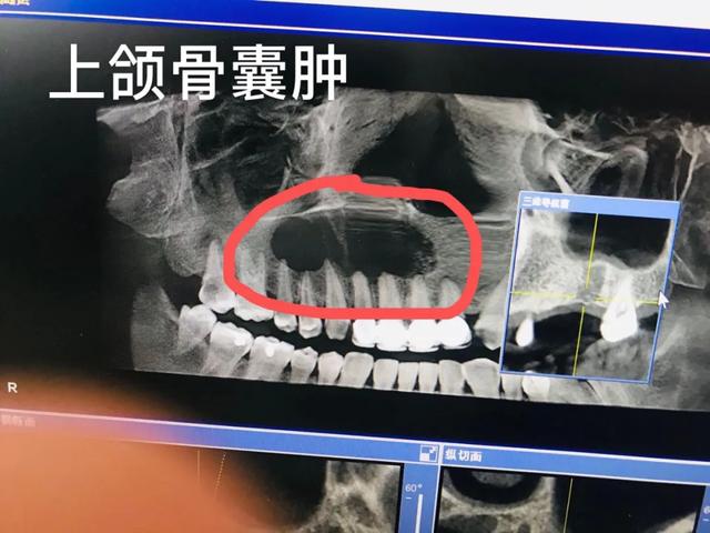 「备孕期」牙病患者需要注意这些