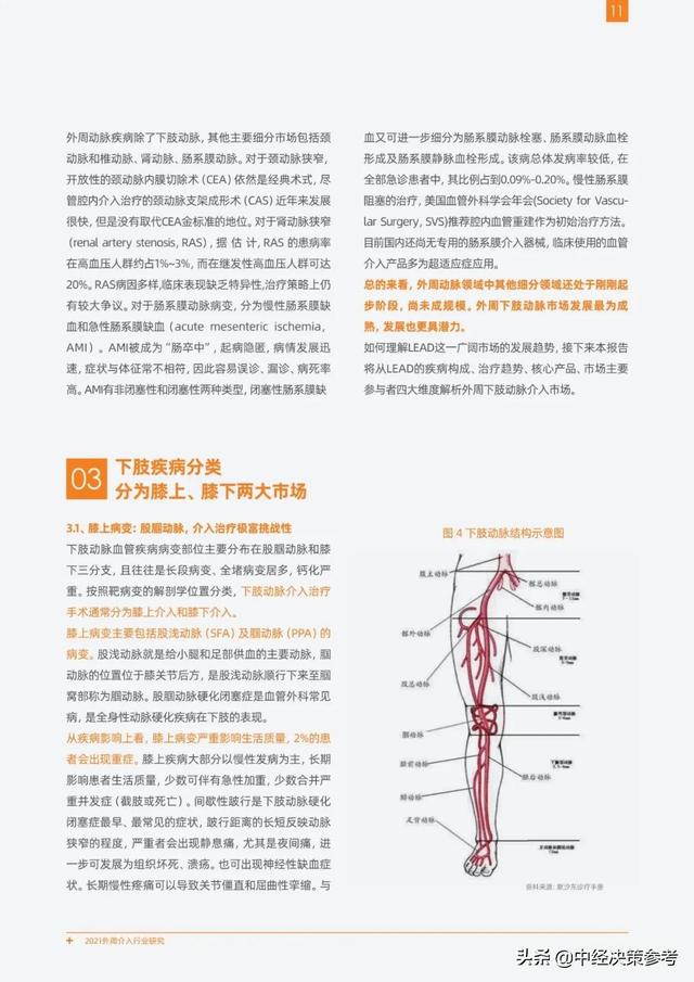 2021外周介入行业研究