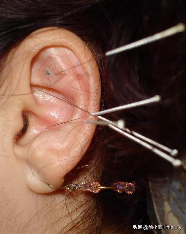 经络到底是什么