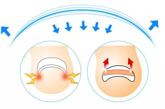 脚趾甲沟炎怎么办