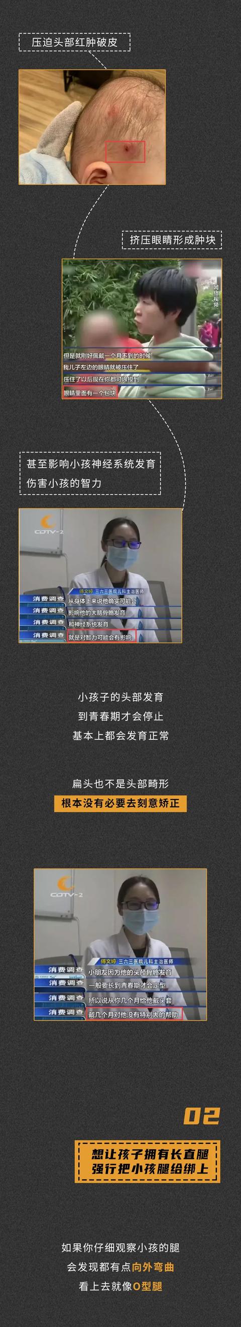 孩子的头都畸形了，他的父母却还在炫耀