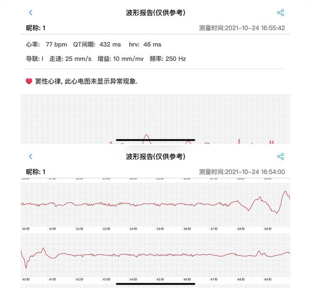 医疗级测血压心率，DIDO Y2智能手环，做你手腕上的健康助手