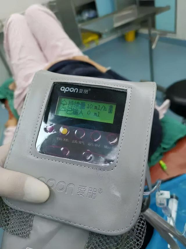 今天开始当妈妈：一个剖腹产不用镇痛泵的女人