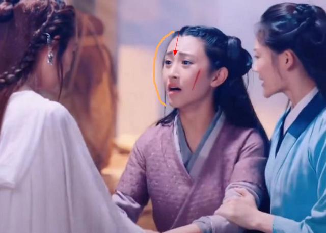 袁心冉:整容明星出演电视剧，一眼看出破绽