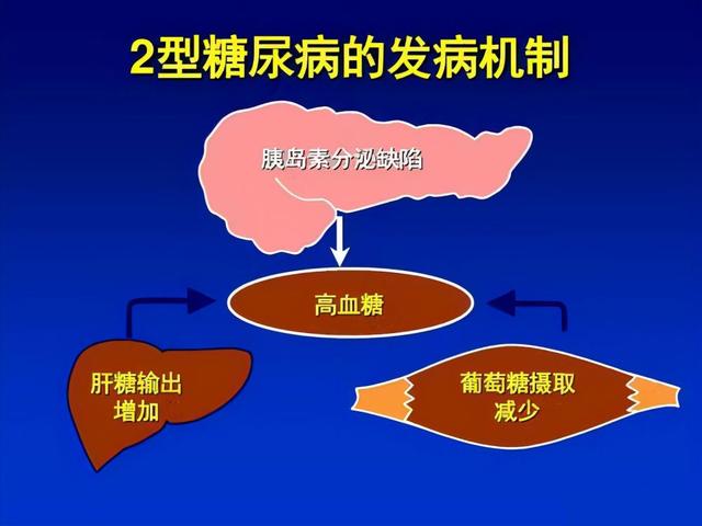 糖尿病为什么越治越严重？答案在这里