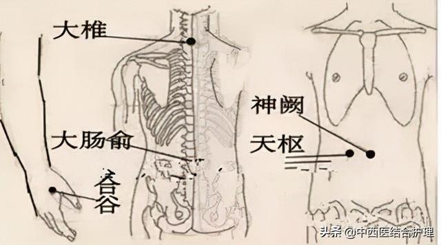 「中医养生」拔罐治疗便秘，一治一个准，一学你就会