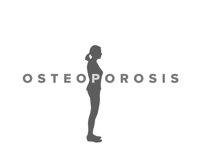 绝经的女性腰腿痛，情绪低落，警惕骨质疏松，如何预防？请看此文