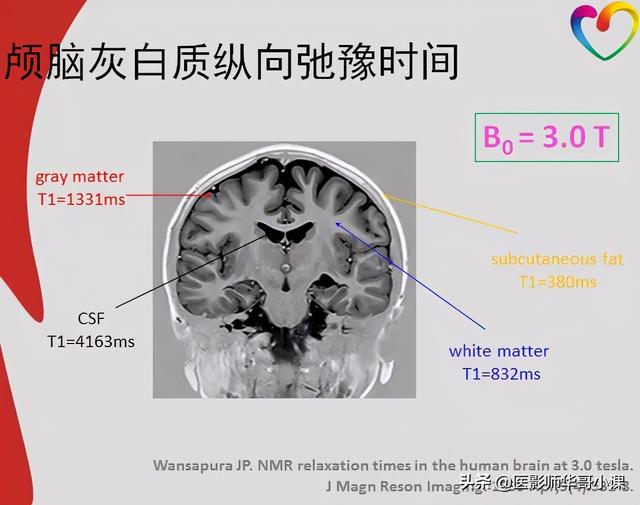 mri检查婴儿t1hi高是什么意思