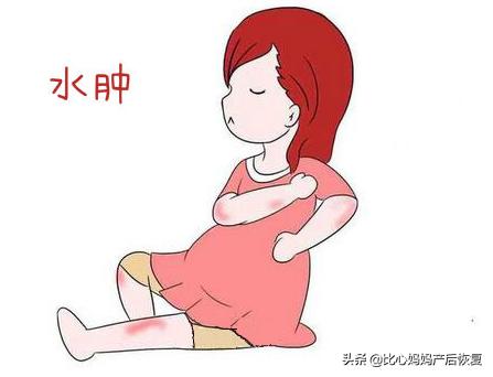 孕期水肿大揭秘！准妈妈们看这里