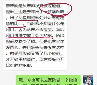 脸上长痘毛囊角化