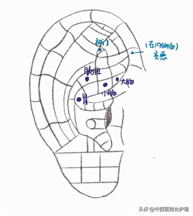 「中医耳穴」耳穴治疗腹泻，这几个穴位记准了