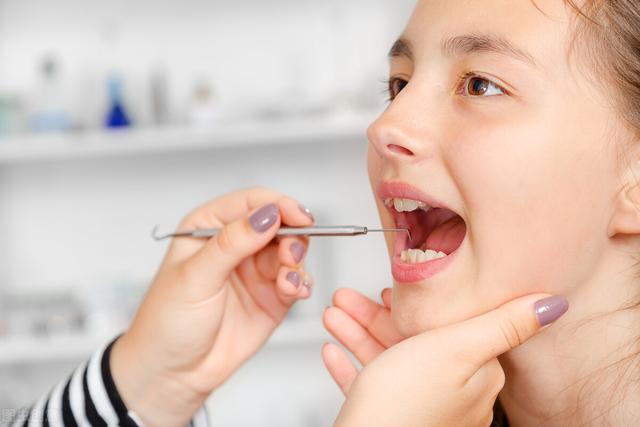 对牙齿不友好的几种食物