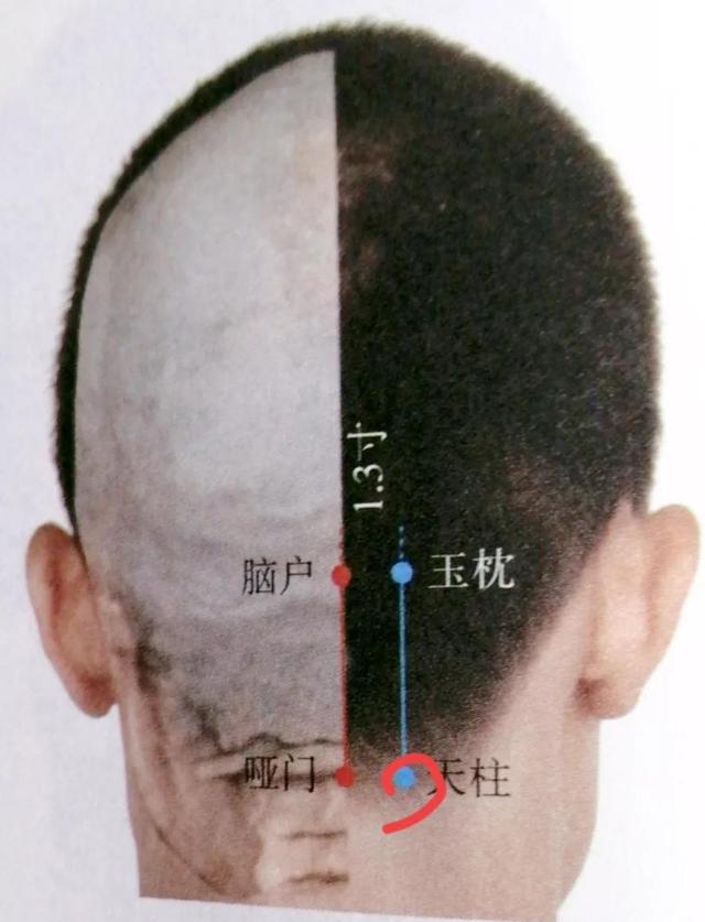 每日一穴——天柱穴
