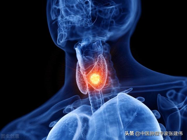 哪種甲狀腺結節最可怕？4個方法判斷結節的良惡性