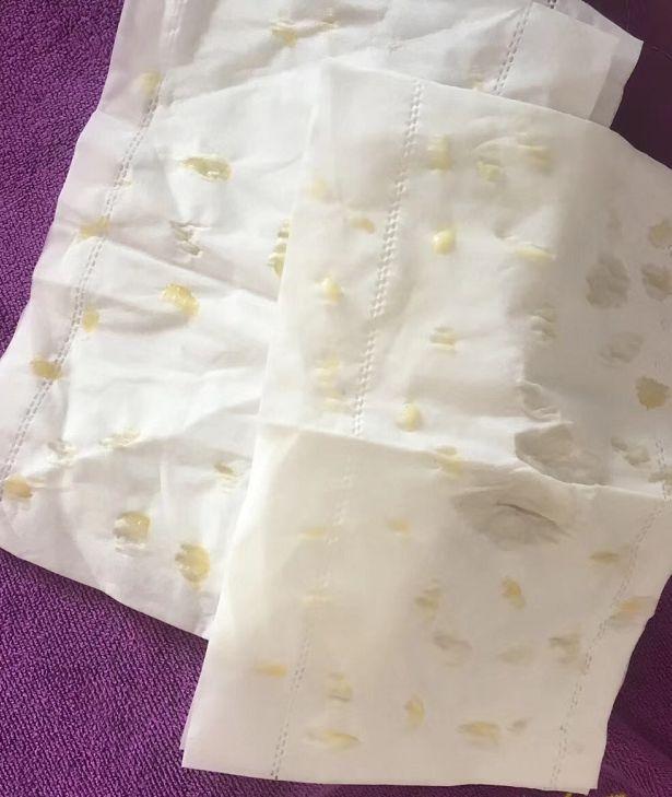 美容院推荐的“排残奶”靠谱吗？不排会诱发癌变？其实真相是这个