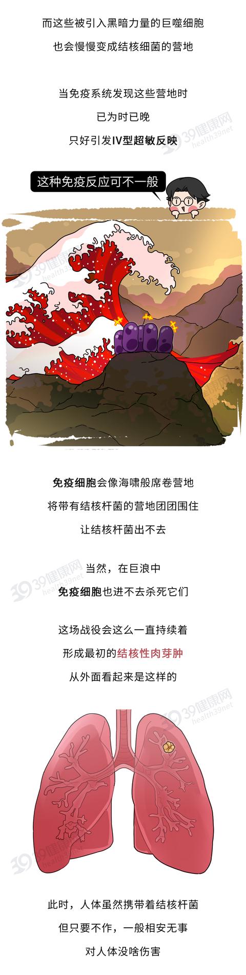 中国结核杆菌感染人数达3.5亿，家里有老幼，需警惕5大症状