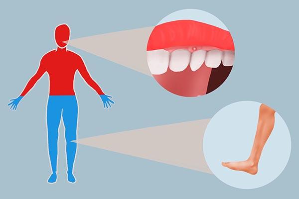 既怕冷又上火，“上热下寒”体质的人，该如何调理？本文给您建议