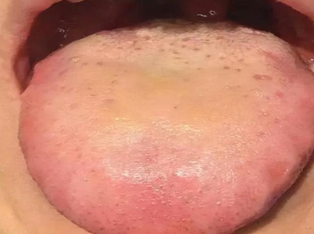 白天调阴阳，晚上安神！教你3个治疗失眠的调理小方