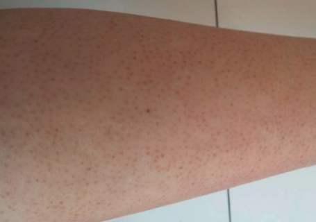 美加净护手霜能当身体乳吗