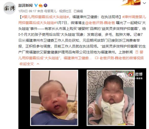 丧尽天良，激素面霜致女婴成“大头娃娃”，你买的面霜可能也有