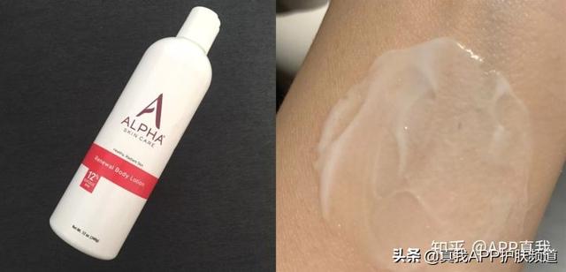 毛周角化症光学美容