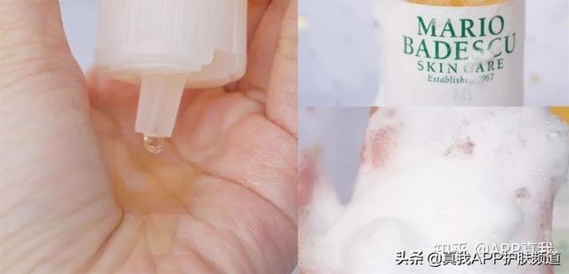 专家推荐祛除鸡皮肤