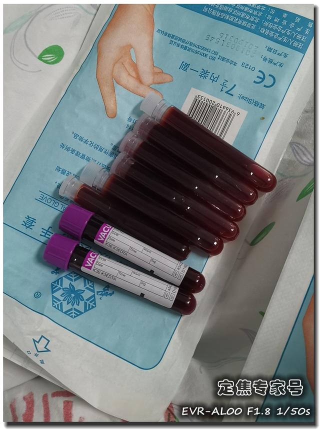 身上起鸡皮疙瘩低烧