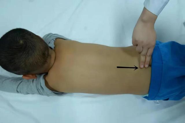 小儿便秘，推拿有妙招，今天于娟教授带您学习如何缓解小儿便秘