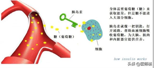 什么是胰岛素抵抗 如何逆转它 听听医生怎么说 今日热点
