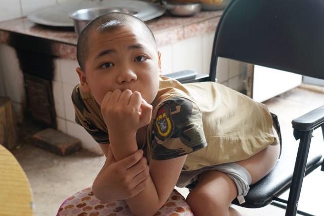 女子意外怀孕后不顾反对生下双胞胎，医生看后断言：活不过18岁