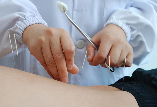 中医针灸不传之秘烧山火、透天凉究竟该如何操作？