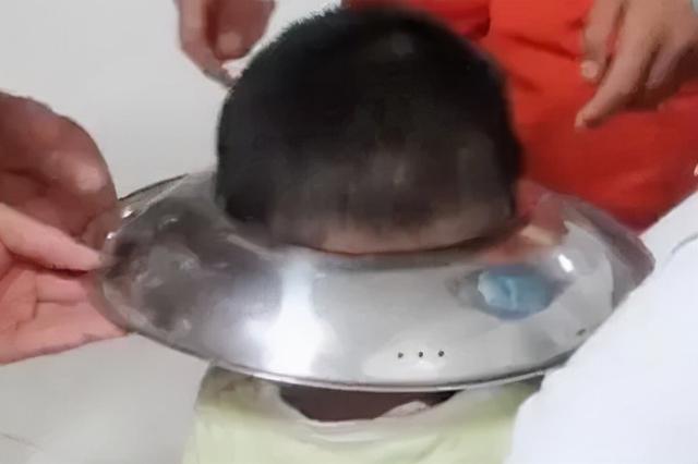 熊孩子的头，无所不卡