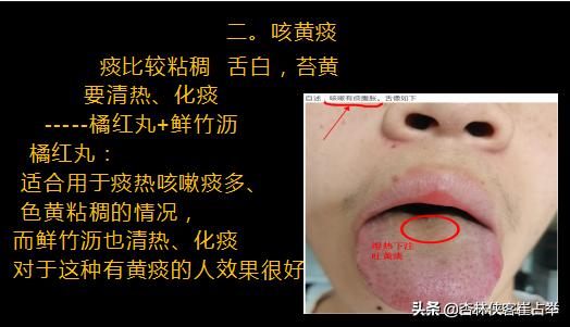 嗓子里面会有痰，但咳不出来？中医：湿气重，调肝、调脾是关键