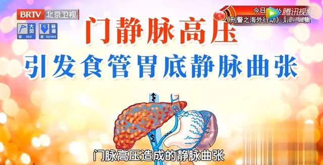 四个异常症状，是肝在求救！专家推荐一个饮食方法，帮您保肝护肝