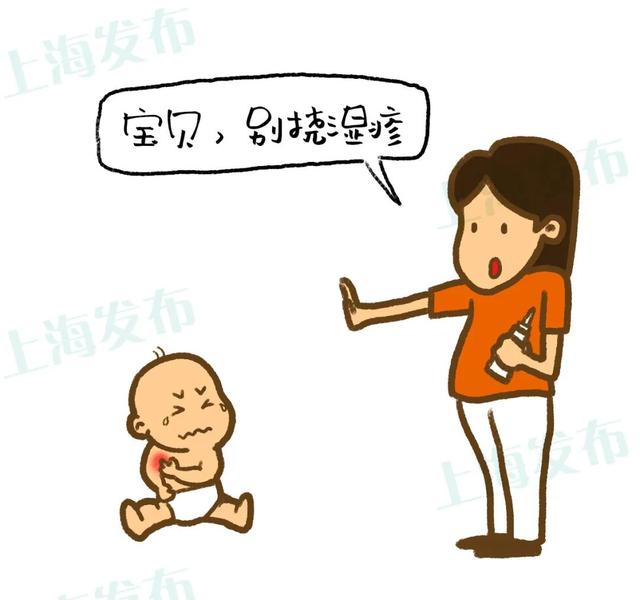 角化湿疹能用黄皮肤软膏吗