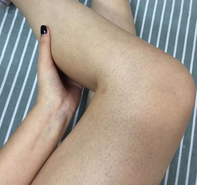 先用身体乳还是维a酸乳膏