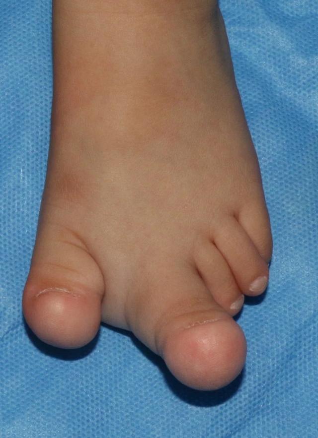 医生我的孩子什么时候可以出院？