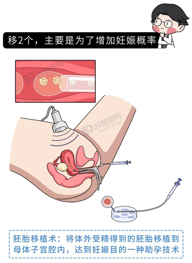 做试管婴儿有多“遭罪”？一篇漫画解释整个过程，看完泪目了