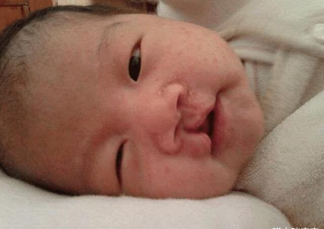 孕妇产下“兔唇宝宝”, 谎称孕期吃了兔肉，被医生揭穿