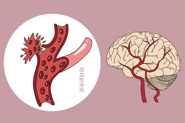 少量喝酒，对健康究竟是好还是不好？50万人追踪研究，给出答案